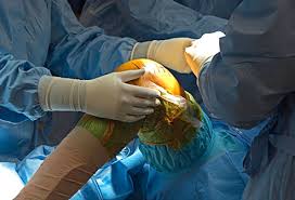 Processo Seletivo para estágio em cirurgia do joelho