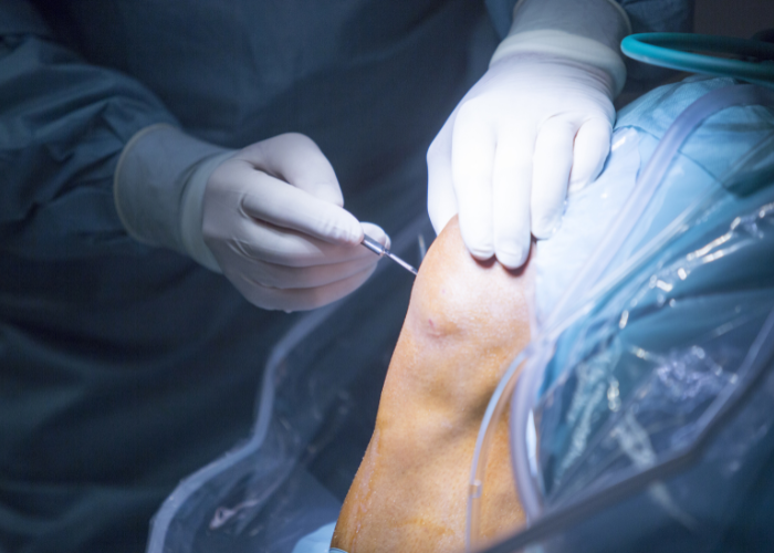 Resultado do Processo Seletivo em Cirurgia do Joelho